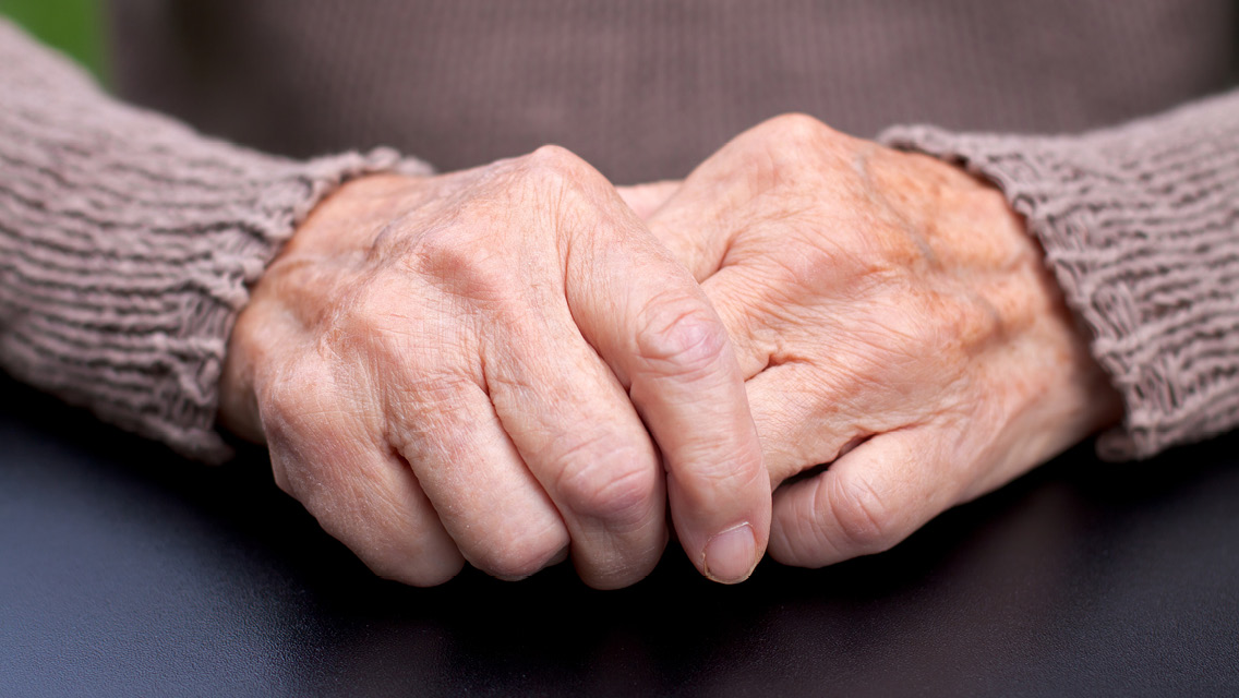 Elderly arthritic hands