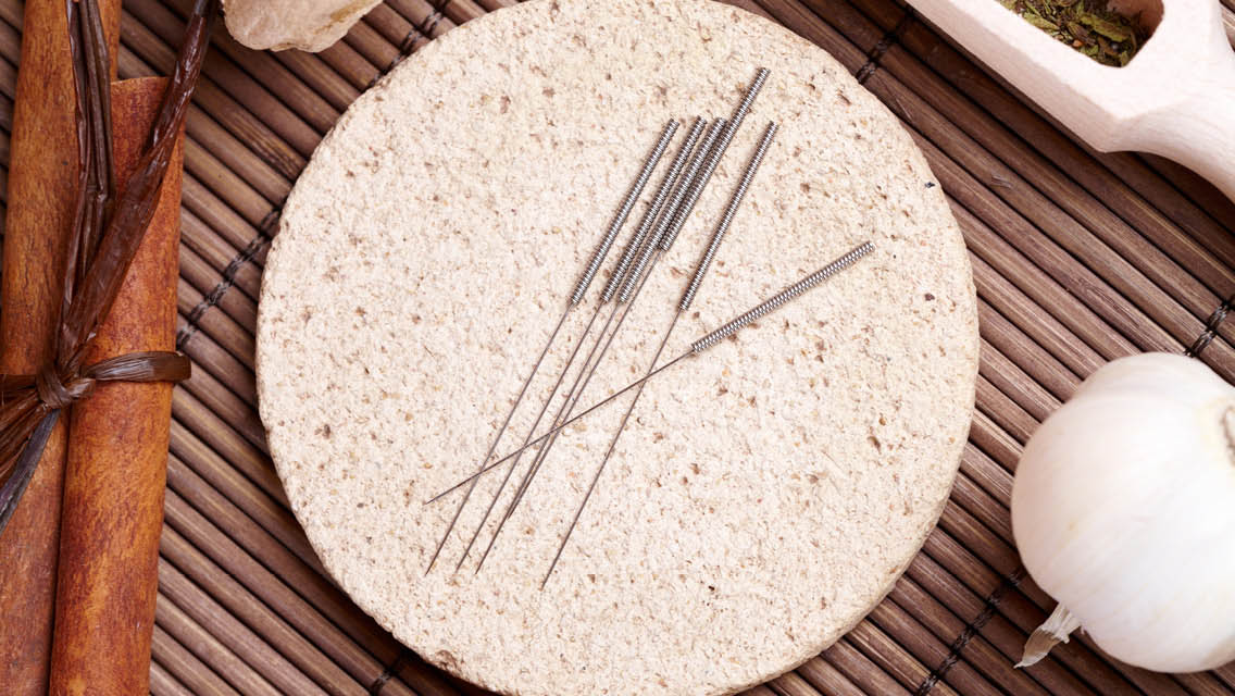 acupuncture needles on a stone