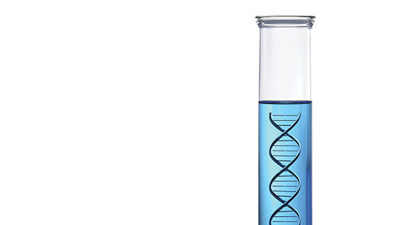 DNA-Discrimination