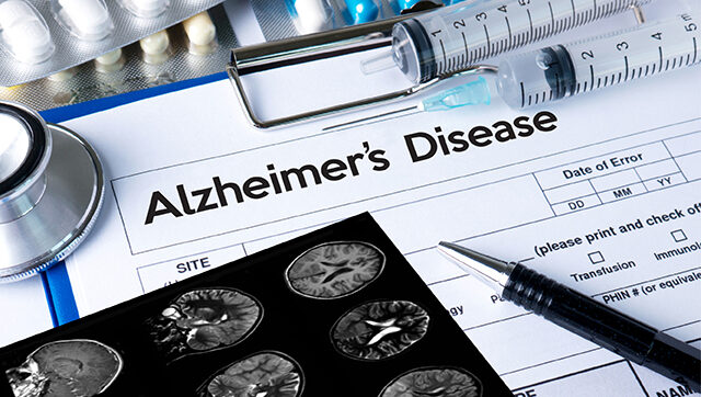 A piece of paper with the words "Alzheimer's Disease" and a brain scan are shown.