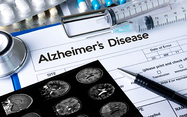 A piece of paper with the words "Alzheimer's Disease" and a brain scan are shown.