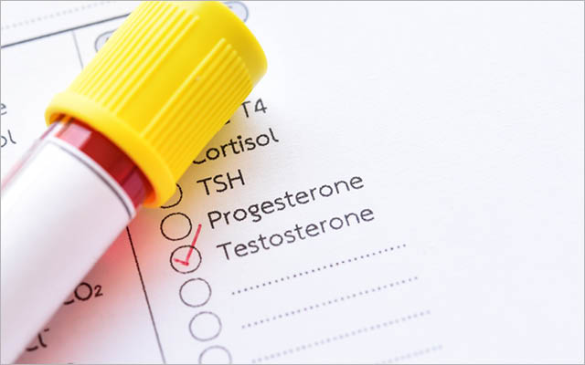 The Problem With Testosterone Testing