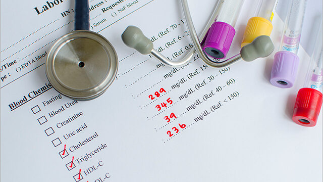 heart-disease-testing