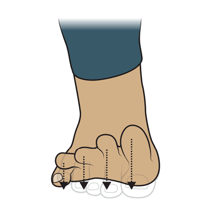 illustration toe waves