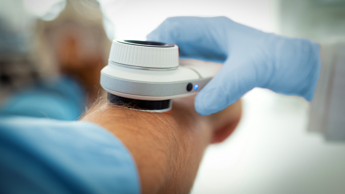 a dermatologist looks at a mole