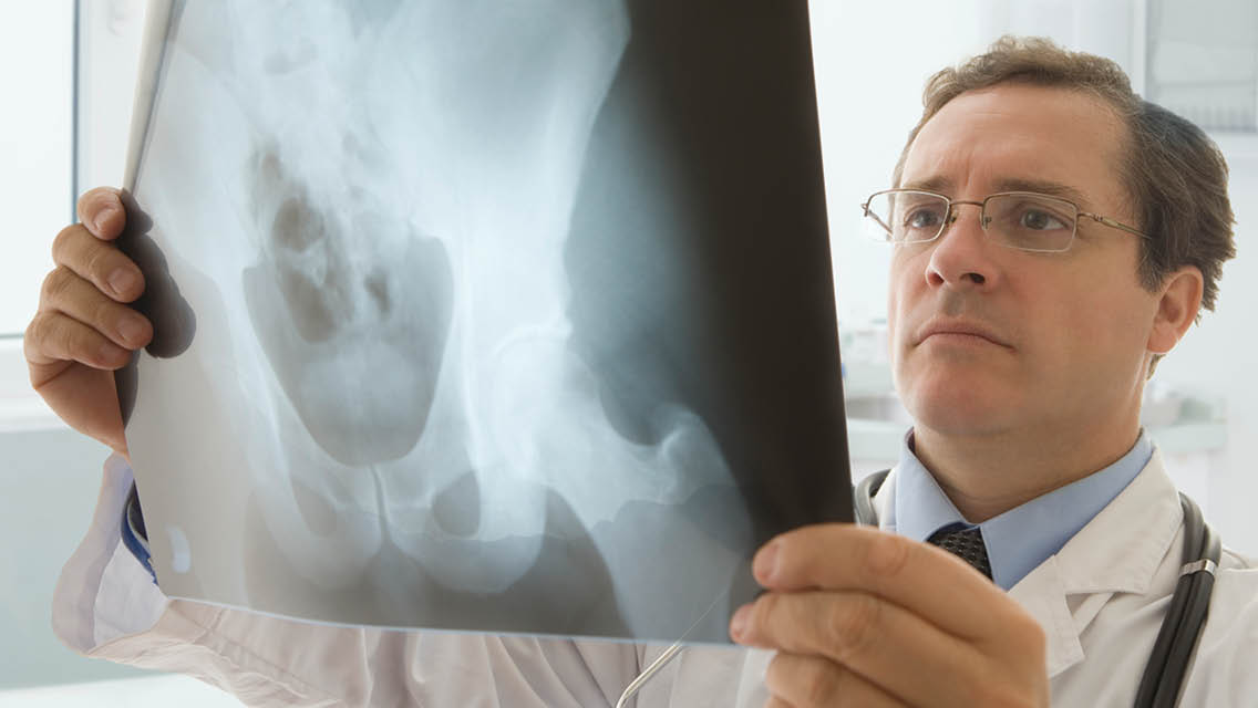 a doctor looks at an x-ray of a pelvis