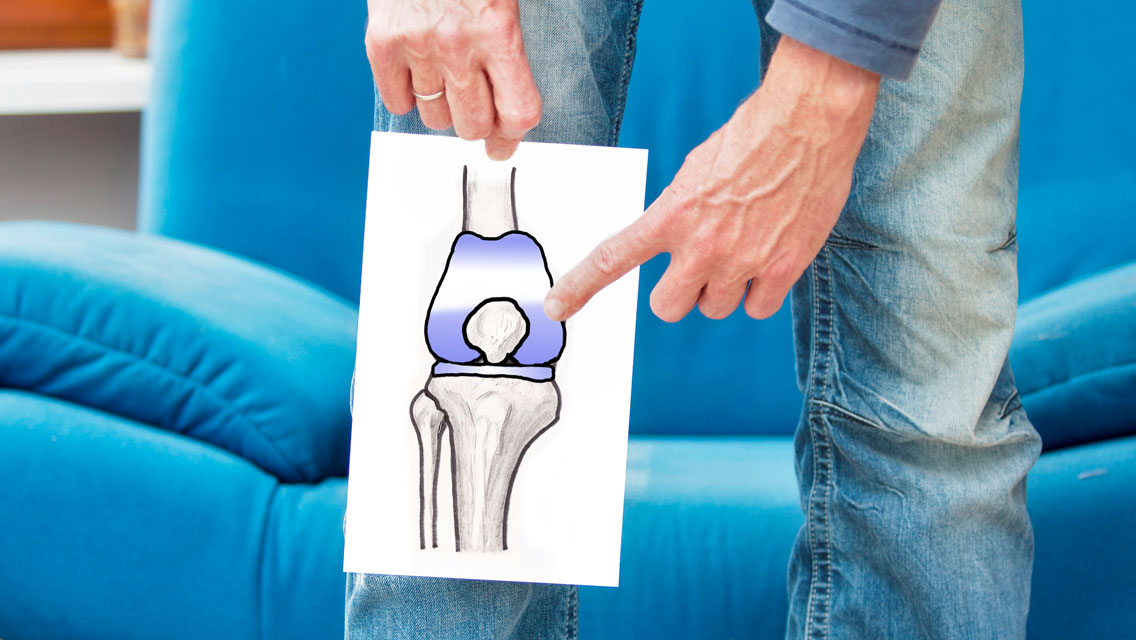 A man points to a graphic of a knee joint over this knee