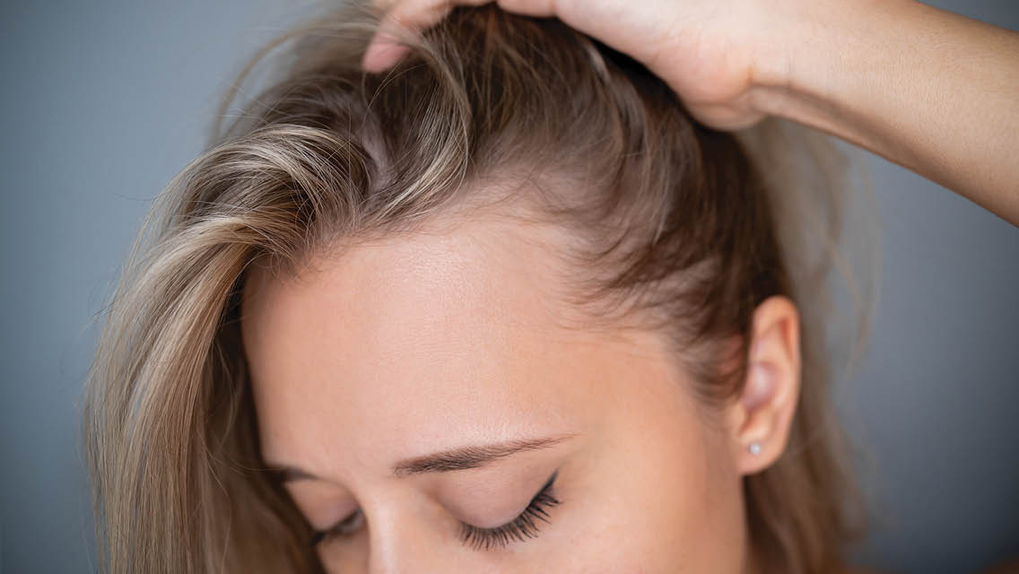 a person showing their scalp