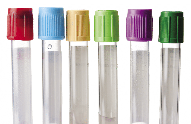 Collection of test tubes used for blood samples on white background 