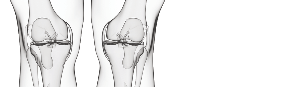 Human leg bones, computer artwork 