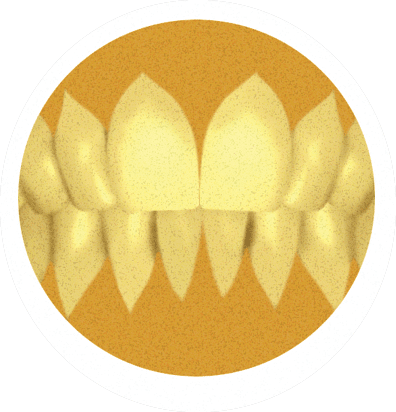 Oval