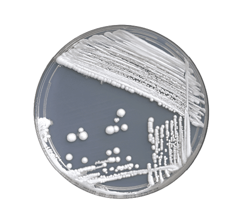 Diagnostic culture of Candida albicans growing on agar plate  C  albicans is the most common cause of human candidiasis  Problems in humans arise when the balance of bacterial and fungal growth is out of balance  The colourless and transparent Sabouraud - Dextrose Agar is stained by a bluish plate placed as background 